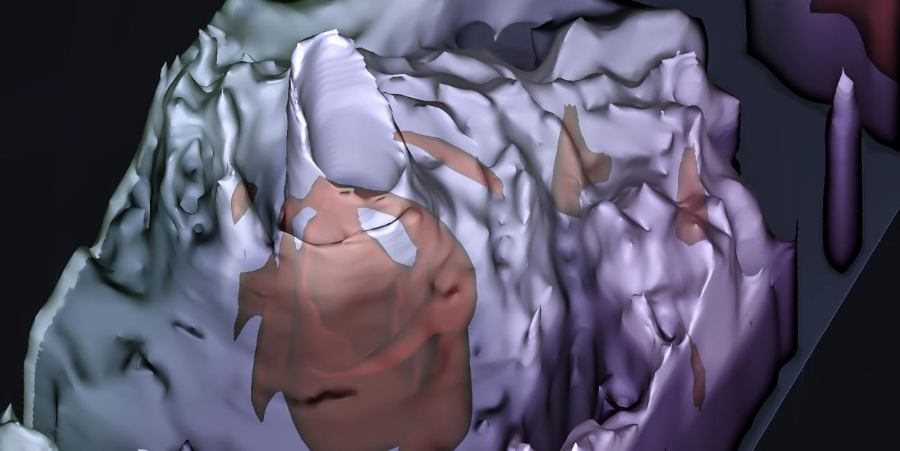 GPM DPR overflight of Sinlaku (2026)