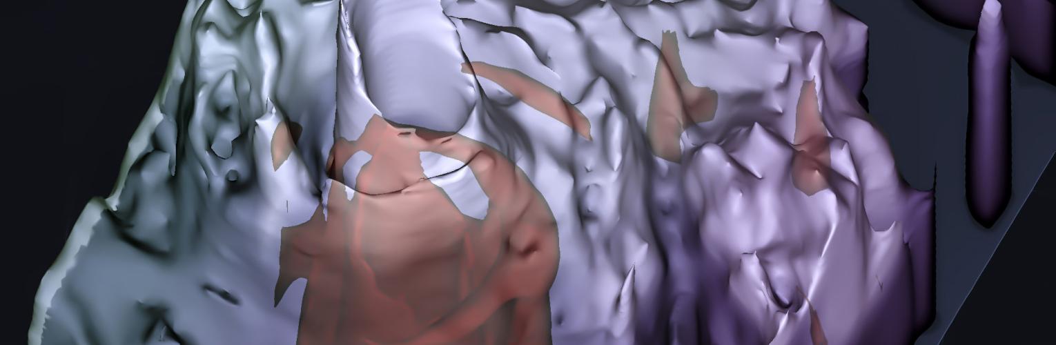 GPM DPR overflight of Sinlaku (2026)